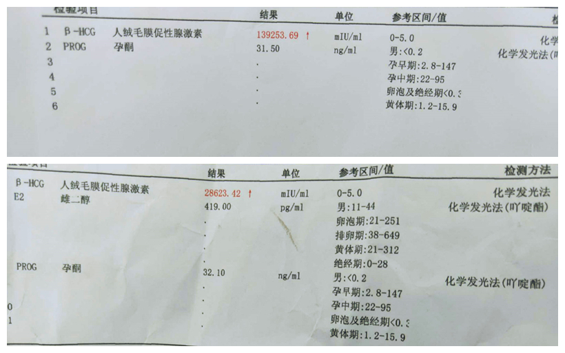 卵巢早衰怀孕难，终于还是走上了试管婴儿的路(图2)