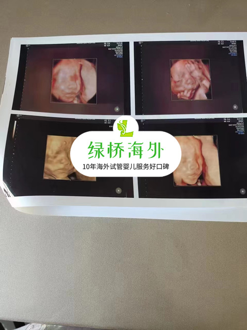 微信图片_20220713145256.jpg