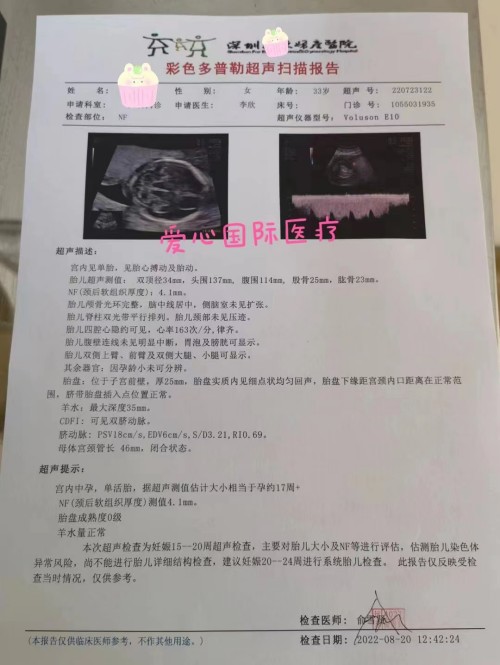 2022.8.26好孕：顺利怀上，翻倍正常，17周啦~