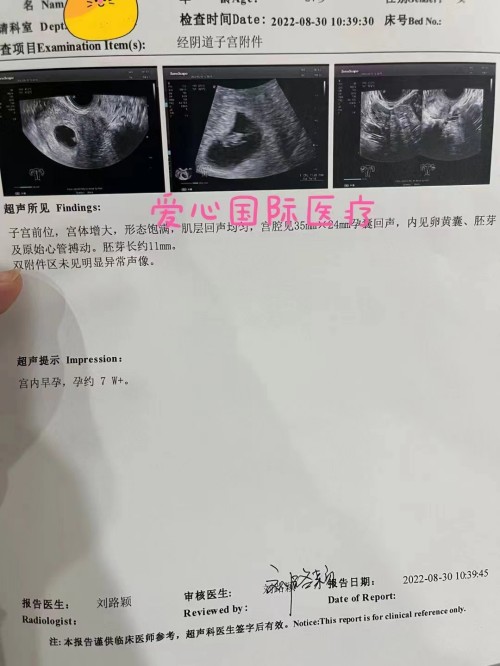 2022.9.6好孕：一超顺利目前7W+了