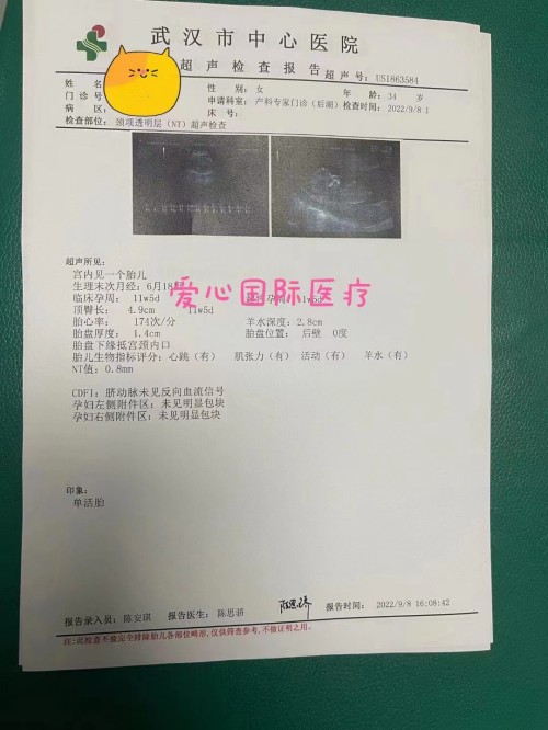 2022.9.13好孕速报：试管准妈妈顺利通过NT