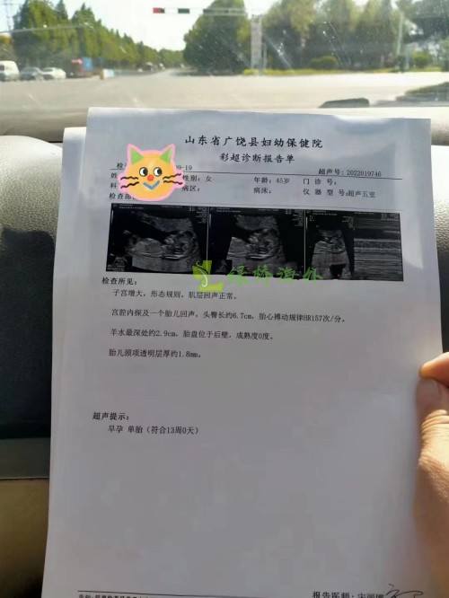 2022.9.21好孕：45岁张女士顺利通过NT