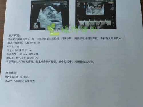 2022.9.23好孕：45岁黄姐顺利过NT(图1)