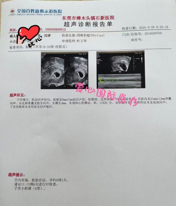 移植男宝宝，一超顺利，6周+好孕报告来了