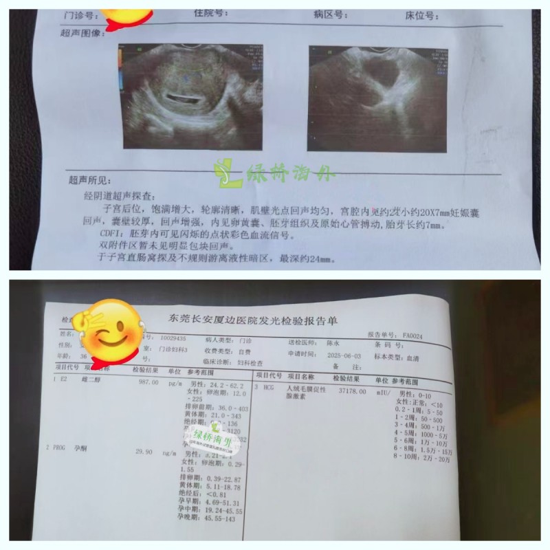 一超顺利出胎心，复查hcg3.7万，加油！